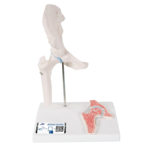 Een anatomisch model mini heup op een standaard.