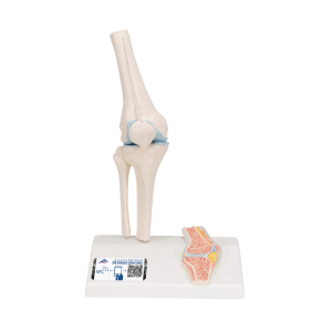 Een anatomisch model mini knie op een standaard