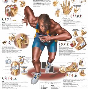 Een poster met daarop alle mogelijke sportblessures in het menselijk lichaam