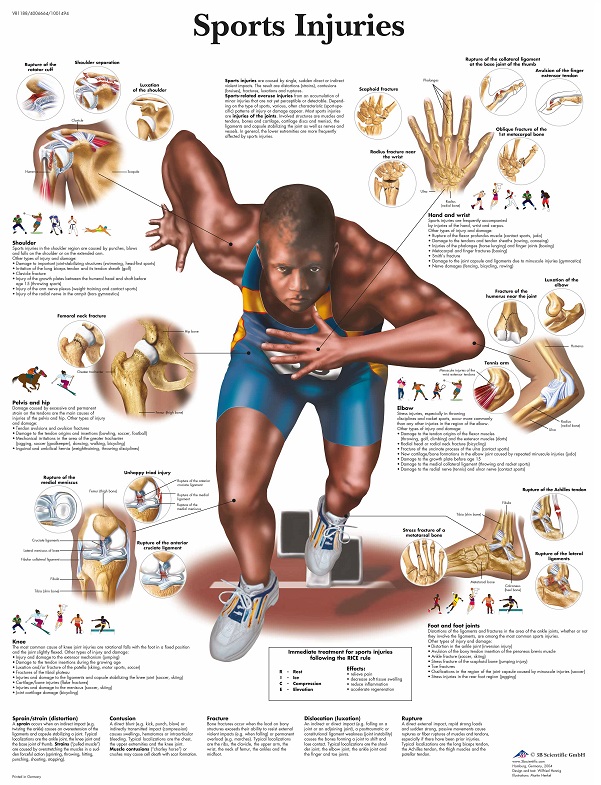 Een poster met daarop alle mogelijke sportblessures in het menselijk lichaam