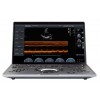 Chison SonoAir Echo Apparaat